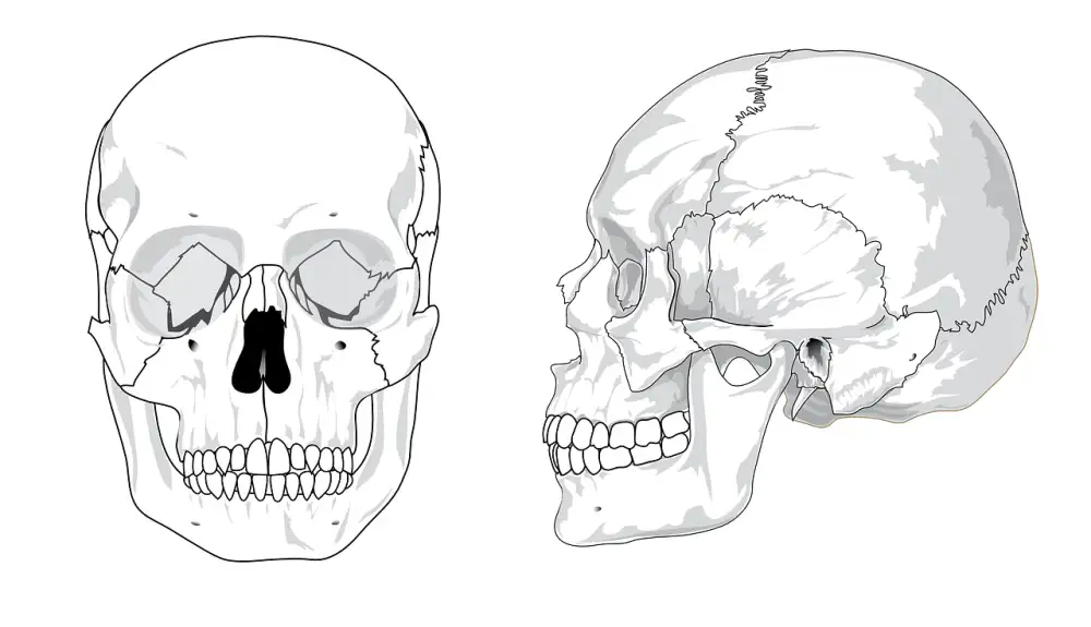 Osteoporóza